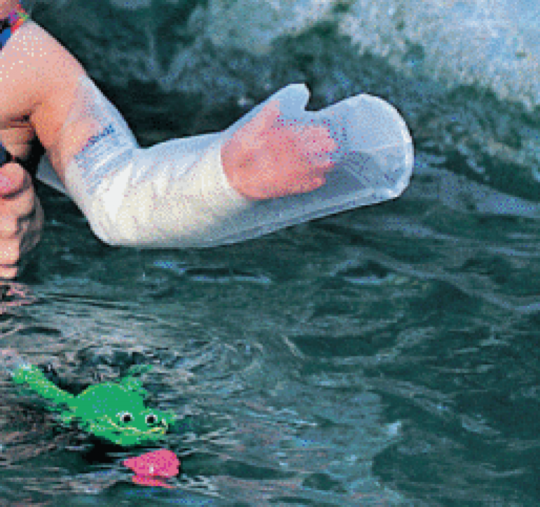 Ped full arm cast protector
